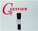 GG1301-500UL GenGreen nucleic acid gel stain 核酸染料 (买GenGreen送蓝光仪活动火爆上市)